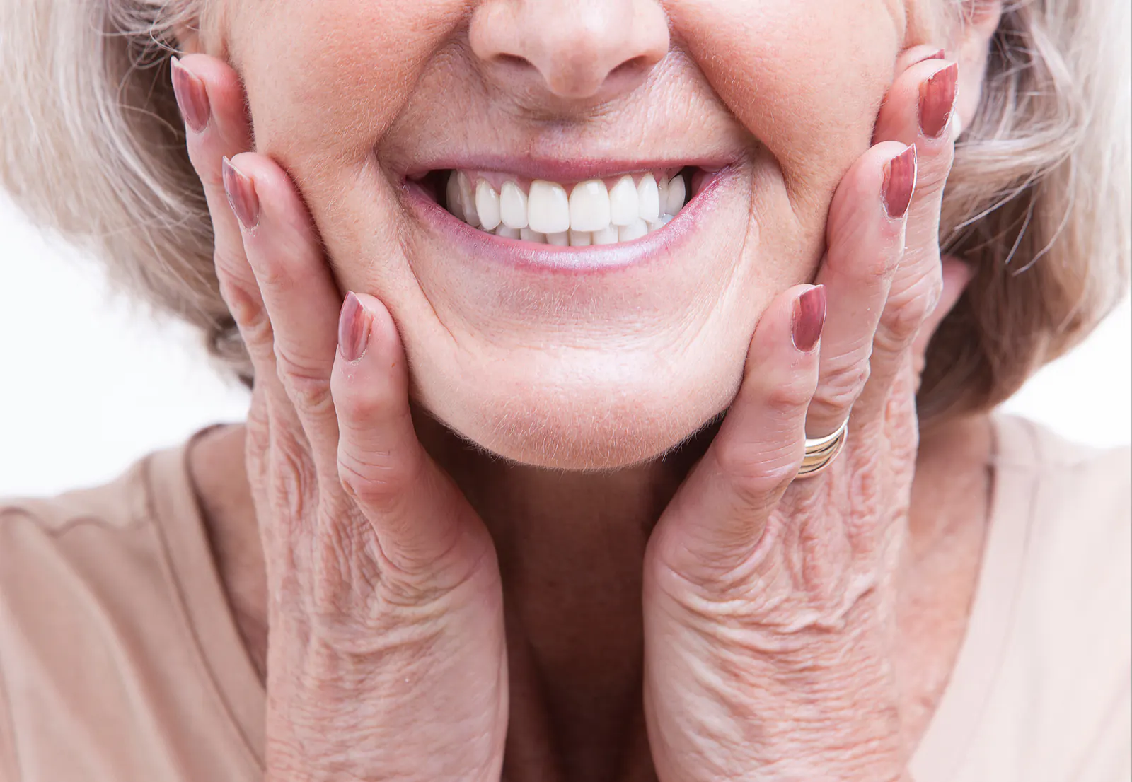 Implant-retained overdenture restoration