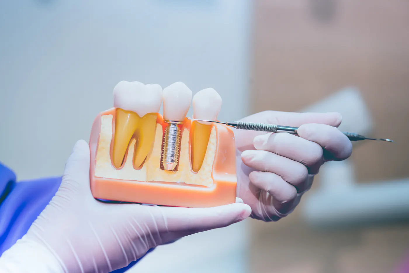 Dr. George Y. Soung - Board Certified Oral Surgeon
